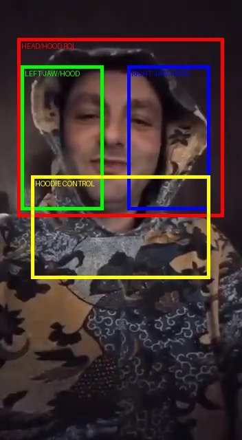 01 rois annotated f547