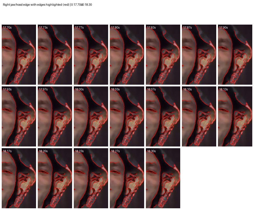 04 micro right jaw edges overlay